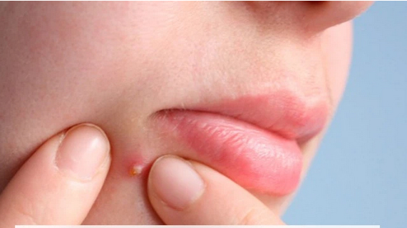 CẢNH BÁO: 8 bước skincare tưởng tốt nhưng lại càng khiến da xấu tệ hại-3