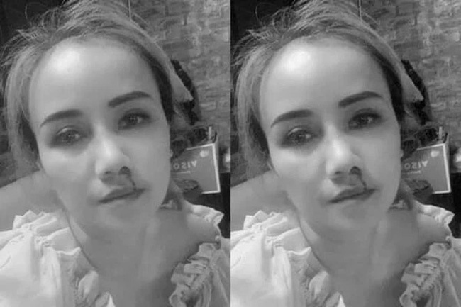 Diễn viên Hoàng Yến Về nhà đi con kể lại sự tình bị chồng cũ đấm gãy mũi ngay giữa quán cafe-2