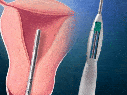 Phương pháp tránh thai mà người giám hộ ép Britney Spears phải dùng, không cho cô sinh thêm con là gì?-3