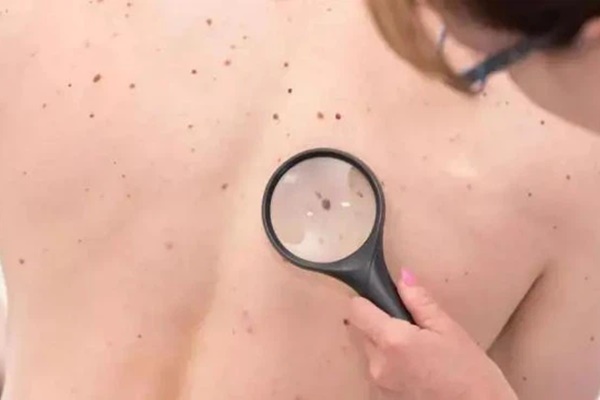 Nữ sinh 13 tuổi bị sốt nhiều tuần được phát hiện mắc ung thư gan vì thường xuyên tiêu thụ 2 loại thực phẩm luôn có sẵn trong mỗi gia đình-4