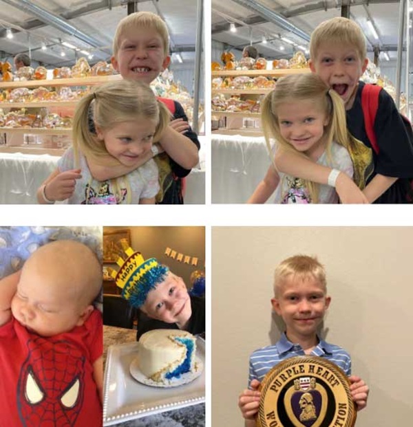 Phải khâu 90 mũi vì xả thân cứu em gái khỏi chó dữ, cậu bé được thế giới phong người hùng” và khuôn mặt hiện tại gây xúc động mạnh-8