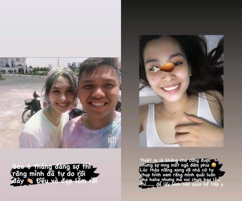 Xinh đẹp không tì vết, Tiểu Vy thú nhận vẫn đang sửa 1 điểm trên mặt-2