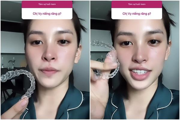 Xinh đẹp không tì vết, Tiểu Vy thú nhận vẫn đang sửa 1 điểm trên mặt-3