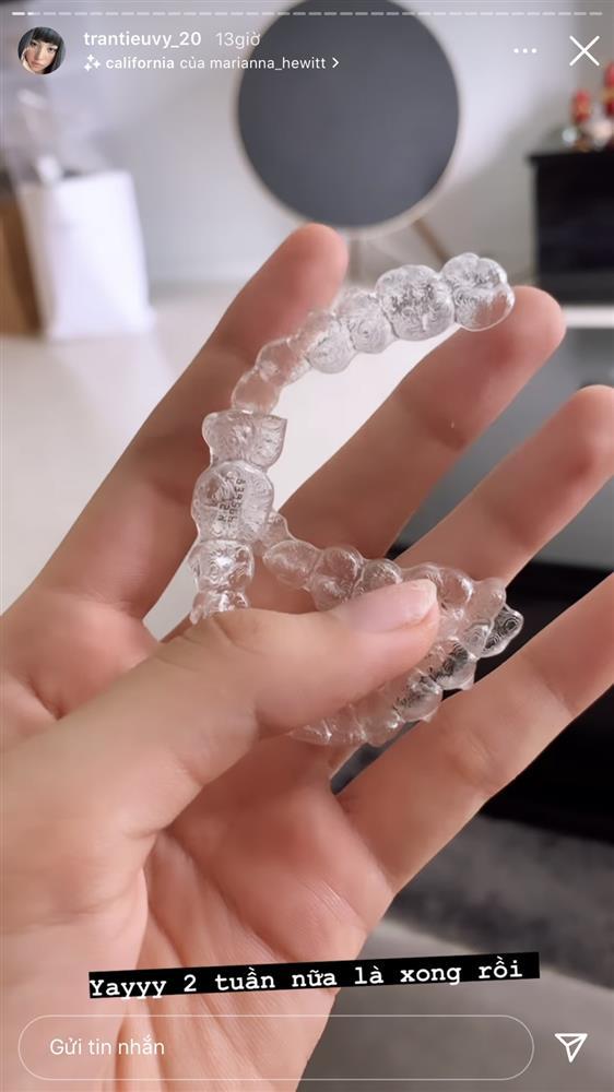 Xinh đẹp không tì vết, Tiểu Vy thú nhận vẫn đang sửa 1 điểm trên mặt-4