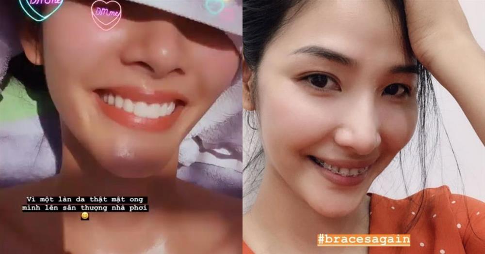 Xinh đẹp không tì vết, Tiểu Vy thú nhận vẫn đang sửa 1 điểm trên mặt-5