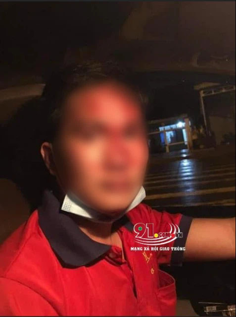 Vụ tài xế taxi bị gã đàn ông côn đồ vô cớ hành hung dã man: Người trong cuộc lên tiếng-2