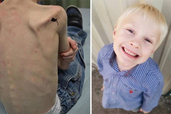 Cuộc sống địa ngục của bé trai bị mẹ kế ngược đãi, giam cầm dưới cầu thang đến tàn tạ và màn 