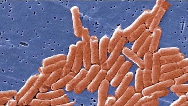 Bé gái 5 tuổi tử vong do ngộ độc sau khi ăn giá đỗ, bác sĩ nhắc nhở 5 điểm lưu ý để đảm bảo an toàn thực phẩm, tránh trường hợp tương tự xảy ra-3