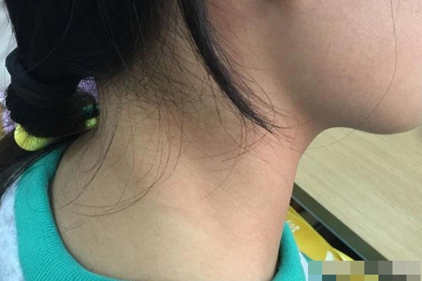 3 bộ phận trên cơ thể tốt nhất không nên để người khác chạm vào, nếu không sẽ chuốc họa vào thân-1