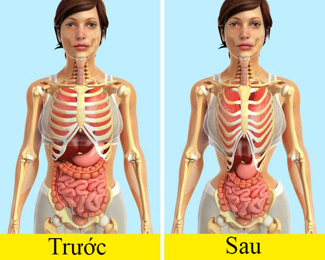 Chị em đeo gen nịt bụng để giảm eo sau sinh mà không biết nó nhiều tác hại: Đẹp chưa thấy đâu, có ngày hối không kịp!-2