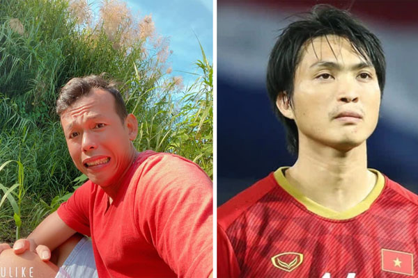 Rùng rợn: Cẳng chân của cầu thủ Ukraine bị đối thủ Thuỵ Điển đạp thành hình gấp khúc-9