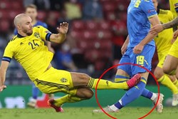 Rùng rợn: Cẳng chân của cầu thủ Ukraine bị đối thủ Thuỵ Điển đạp thành hình gấp khúc