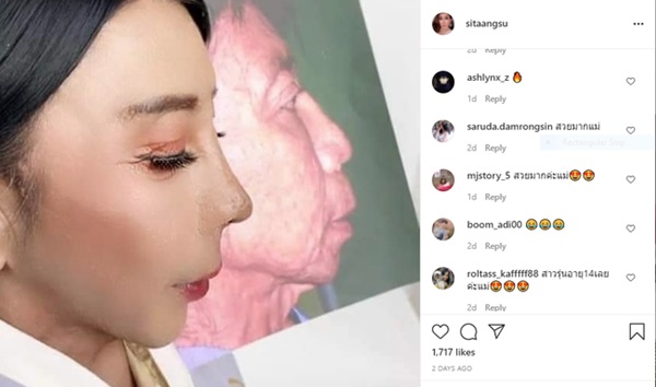 Hotgirl mặt nhàu” sở hữu khuôn mặt nhăn nheo như bà lão bỗng khoe ảnh căng da sang-xịn-mịn khiến dân mạng choáng váng-4