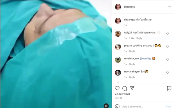 Hotgirl mặt nhàu” sở hữu khuôn mặt nhăn nheo như bà lão bỗng khoe ảnh căng da sang-xịn-mịn khiến dân mạng choáng váng-6