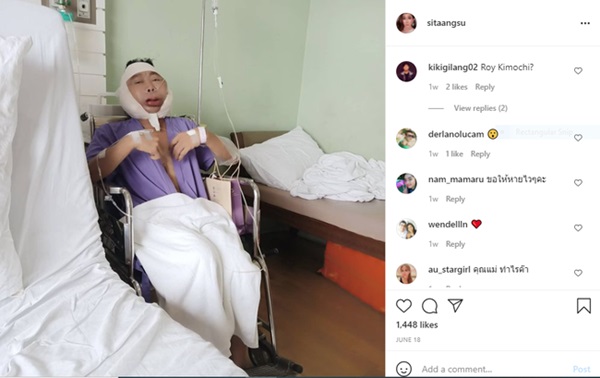 Hotgirl mặt nhàu” sở hữu khuôn mặt nhăn nheo như bà lão bỗng khoe ảnh căng da sang-xịn-mịn khiến dân mạng choáng váng-7