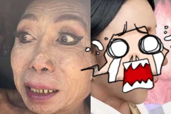 “Hotgirl mặt nhàu” sở hữu khuôn mặt nhăn nheo như bà lão bỗng khoe ảnh căng da sang-xịn-mịn khiến dân mạng choáng váng