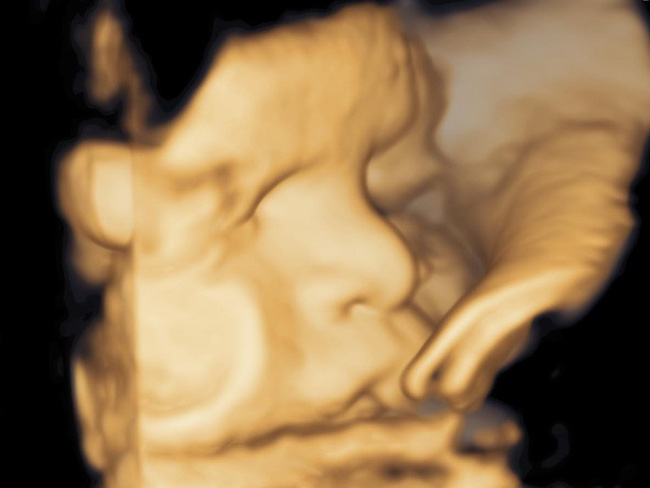 Võ Hạ Trâm khoe ảnh con gái mũi cao thẳng tắp, 37 tuần mới chịu làm việc này khiến mẹ mừng rơi nước mắt-1