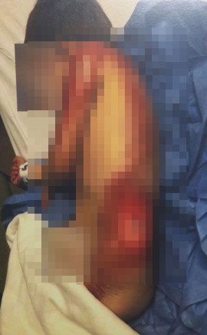 Bố mẹ để con nhỏ nghịch máy chạy bộ khiến đứa trẻ bị nuốt vào gầm gây ra cảnh tượng ám ảnh-2