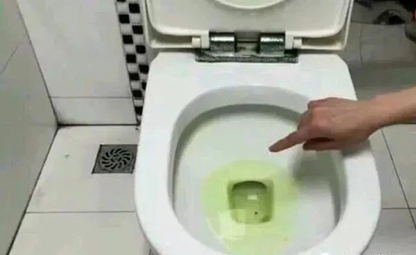 3 biểu hiện bất thường ở nước tiểu cho thấy lượng đường trong máu của bạn đang tăng cao, cần đi khám càng sớm càng tốt-1