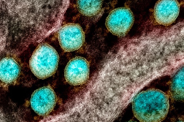 Phát hiện siêu kháng thể chống được 23 biến chủng nCoV-1