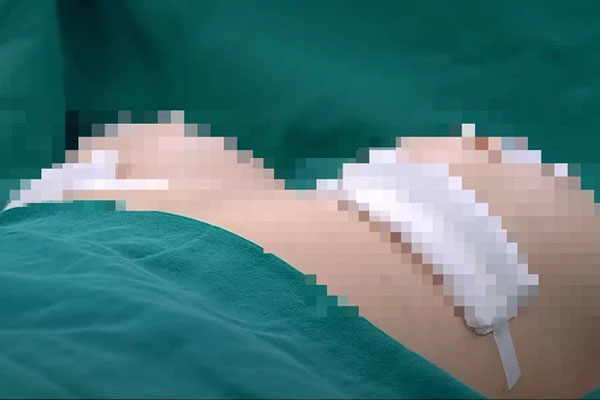 Vụ bác sĩ chở thi thể cô gái nâng ngực tử vong đến trại hòm: Chồng nạn nhân tiết lộ vợ khỏe mạnh, chưa từng đi làm đẹp-2