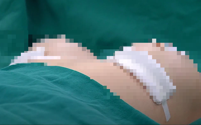 Vụ bác sĩ chở cô gái nâng ngực tử vong từ TP.HCM về Trà Vinh: Bác sĩ khai không biết đường về nhà nạn nhân nên tự đưa đi khâm liệm-1