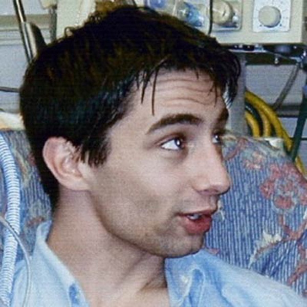 Từng bị vợ bỏ vì quá xấu xí, người đàn ông dị dạng không mặt” gây bất ngờ với cuộc sống và diện mạo hiện tại sau phẫu thuật-1