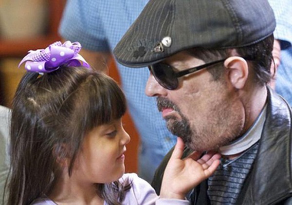 Từng bị vợ bỏ vì quá xấu xí, người đàn ông dị dạng không mặt” gây bất ngờ với cuộc sống và diện mạo hiện tại sau phẫu thuật-5