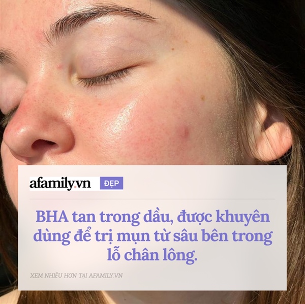 Dùng AHA và BHA như thế nào là đúng nhất: Đây là 2 chỉ dẫn đáng nhớ từ chuyên gia da liễu-4