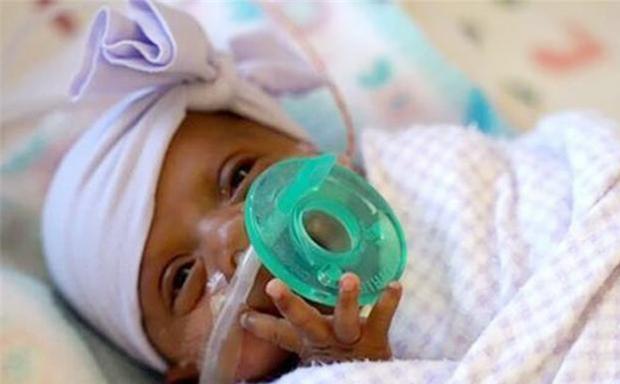 Em bé nhỏ nhất thế giới có chiều dài cơ thể chỉ bằng một cái bút, cuộc sống hiện tại khiến nhiều người bất ngờ!-8