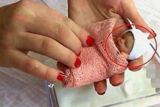 Em bé nhỏ nhất thế giới có chiều dài cơ thể chỉ bằng một cái bút, cuộc sống hiện tại khiến nhiều người bất ngờ!
