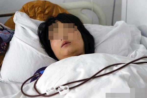 3 biểu hiện bất thường trên khuôn mặt cho thấy bạn đang có nguy cơ mắc ung thư gan-4