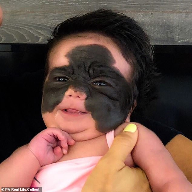 40% vết bớt của em bé không phải do di truyền, mà là do mẹ bầu có 4 hành vi này!-2