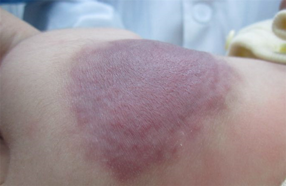 40% vết bớt của em bé không phải do di truyền, mà là do mẹ bầu có 4 hành vi này!-3