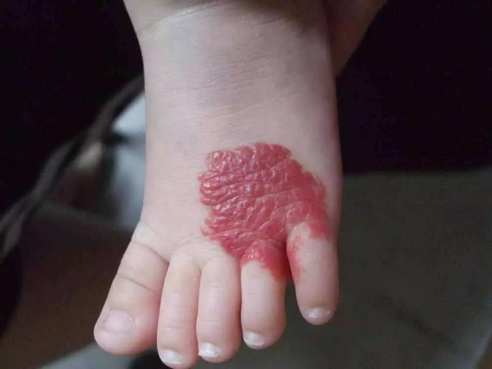 40% vết bớt của em bé không phải do di truyền, mà là do mẹ bầu có 4 hành vi này!-4