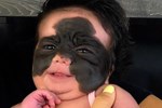 Thấy con 9 tuần tuổi bị nổi mụn ở mặt, người mẹ làm ngay chiếc mặt nạ đắp cho bé, biết thành phần nhiều người lo lắng-3