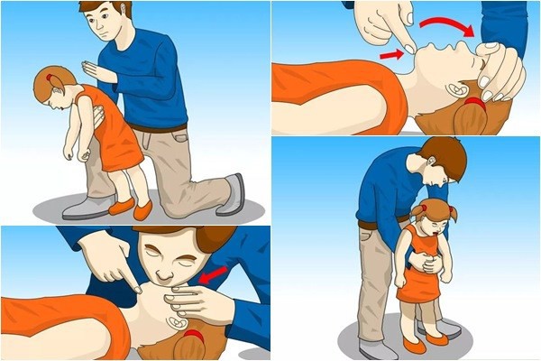 Bé 1 tuổi nôn trớ, tắc ruột vì một món đồ chơi: Cha mẹ tốt nhất đừng bao giờ mua thứ này cho trẻ-3