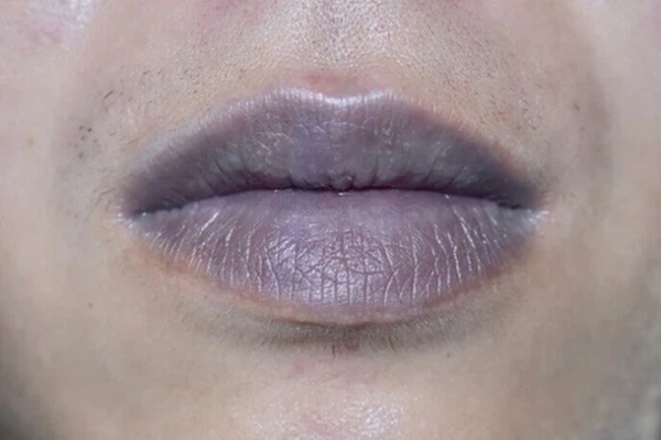 3 biểu hiện bất thường trên khuôn mặt cho thấy bạn đang có nguy cơ mắc ung thư gan-2