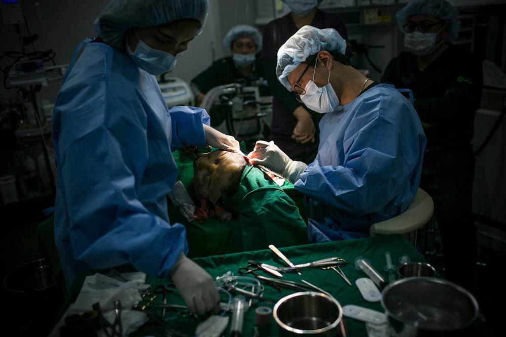 Mở rộng tai, làm teo cơ chân, phụ nữ Trung Quốc bất chấp để đẹp lên-4