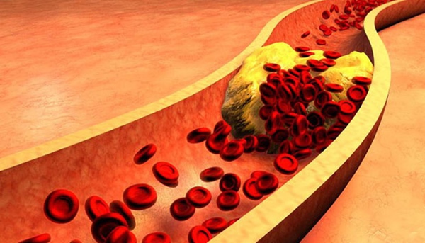 Nếu 3 chỗ trên cơ thể luôn CỨNG có nghĩa rằng tuổi thọ ngắn và khả năng mắc bệnh cao hơn người khác-4