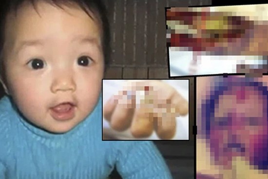 Bé trai 2 tuổi bị bạo hành đến chết: 21 ngày địa ngục chịu sự tra tấn bằng ma túy và bạo lực, thi thể không còn ra hình hài
