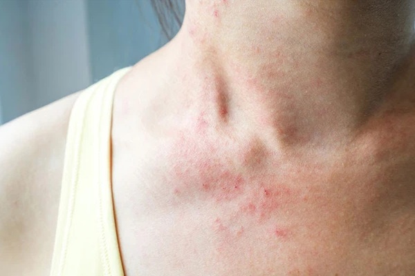 Người phụ nữ 28 tuổi được chẩn đoán ung thư dạ dày, bác sĩ cảnh báo: 2 loại thực phẩm này để trong tủ lạnh lâu ngày, tất cả đều là chất gây ung thư-7