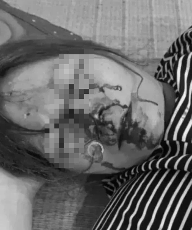 Hải Phòng: Người phụ nữ cầu cứu vì bị hàng xóm dùng lốp xe ngoặc vào cổ, kéo lê dưới đường-1