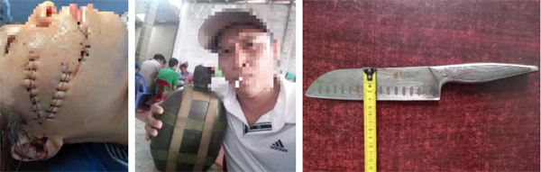 Clip: Vợ xin làm tăng ca, chồng rút dao chém liên tiếp vào mặt vợ vì nghi ngờ nói dối-1