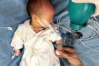 Bé sơ sinh 7 ngày tuổi bị sặc sữa tím tái toàn thân, không còn nhịp tim và hơi thở