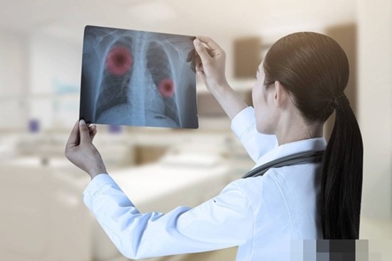 Bác sĩ trưởng khoa ung bướu tiết lộ những người 
