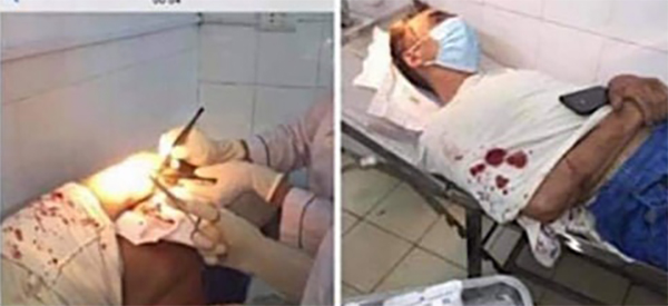 Vợ chém chồng hàng chục nhát phải nhập viện cấp cứu ở Vĩnh Phúc-1