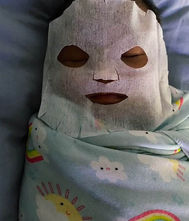 Thấy con 9 tuần tuổi bị nổi mụn ở mặt, người mẹ làm ngay chiếc mặt nạ đắp cho bé, biết thành phần nhiều người lo lắng-2