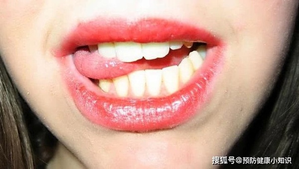 Cô gái 24 tuổi bị nhồi máu não trong đêm khuya, BS cảnh báo thói quen sau khi quan hệ tình dục có thể gây hại sức khỏe-4