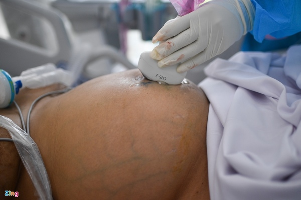 Ranh giới sinh tử ở Bệnh viện Hồi sức Covid-19 TP.HCM-6